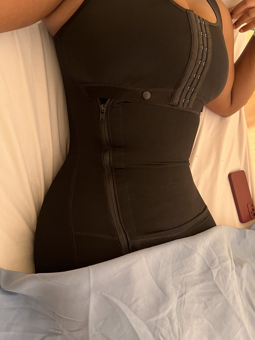 Liposuction photo 25